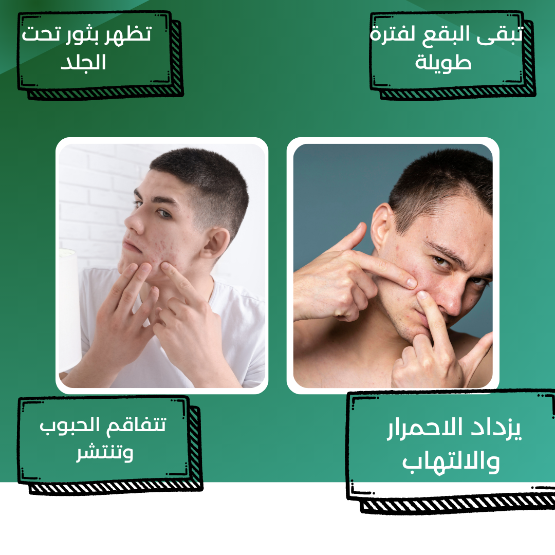 Before treatment