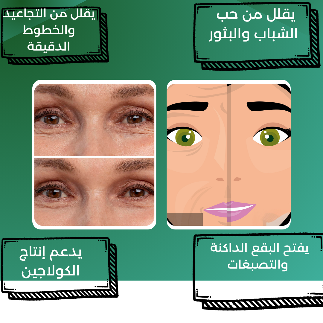 After Retinol Cream